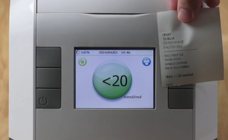 HbA1c testing device with built-in small screen and printer
