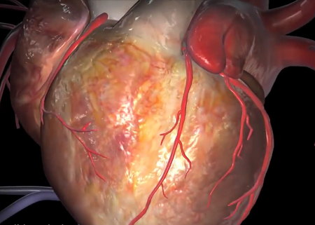 Coronary arteries and arterial branches on surface of the heart